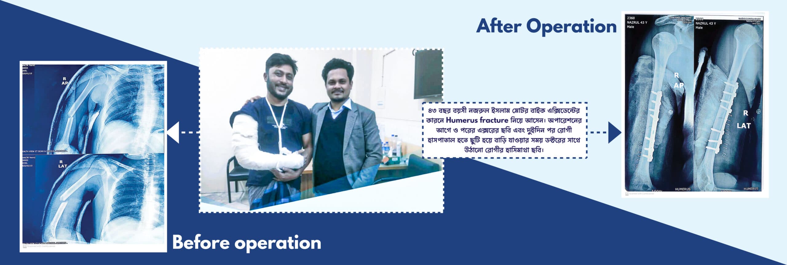 treatment BAnner